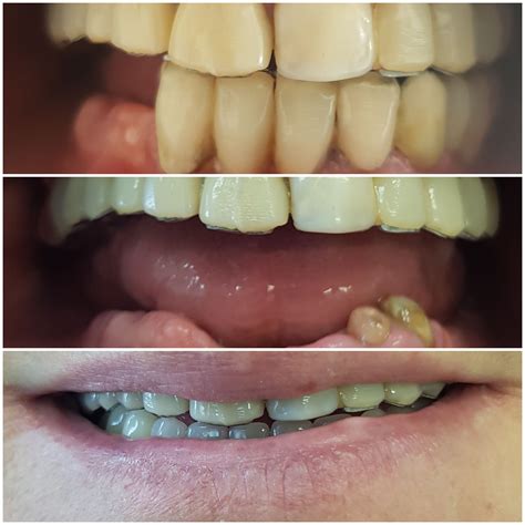 Dr. Mares Andreea - Cu multa munca, pornind de la prima imagine am