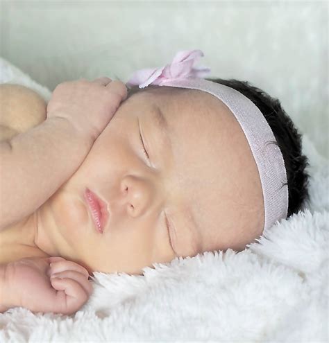 Kylie Anne's Journey with Craniosynostosis