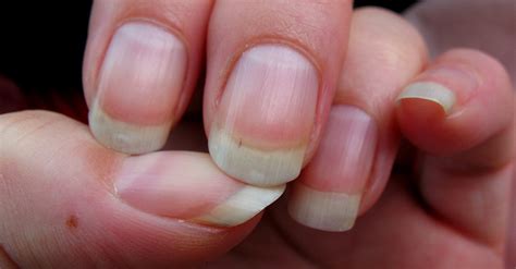 red fingernail beds design talk vrogueco