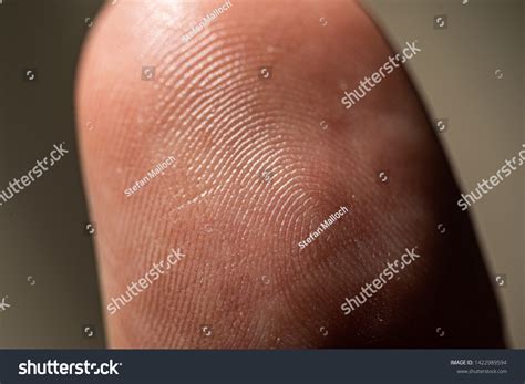 Hair Growing Mole Images: Browse 20 Stock Photos & Vectors Free ...