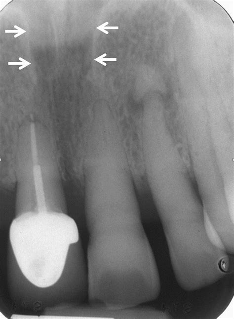 Oral and Maxillofacial Anatomy - Radiologic Clinics
