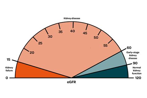 stages  chronic kidney disease ckd kidney care uk