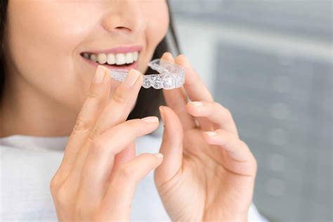 Can I Get Invisalign on Just My Top or Bottom Teeth? - Woodbridge