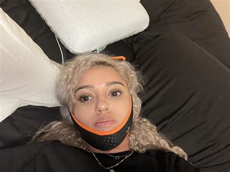 Macaiyla’s Journey Through Jaw Surgery: A Transformation Story