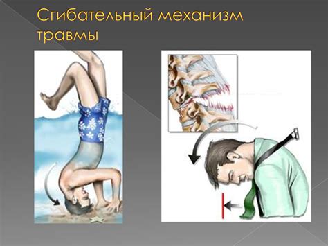 Повреждения позвоночника - презентация онлайн