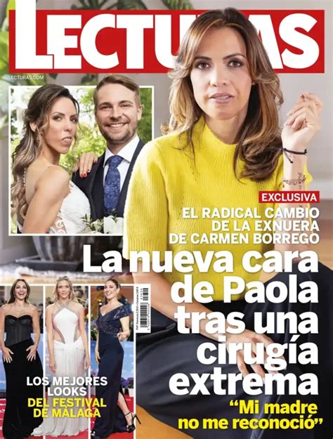 El cambio radical de Paola Olmedo tras la cirugía