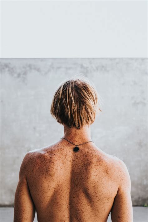 2 Types of Skin Discoloration and How to Treat Them – MirraSkincare