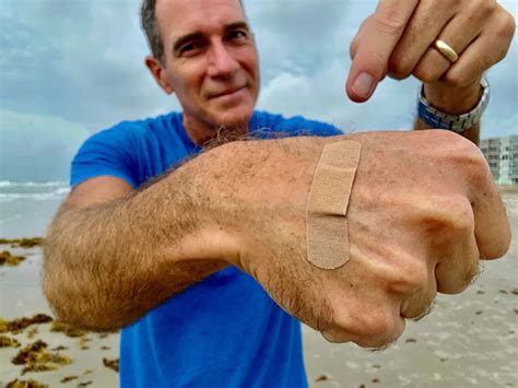 deadly flesh eating bacteria  thrive   beach   stay safe