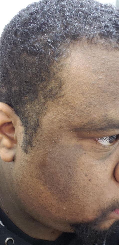 face with spots 8