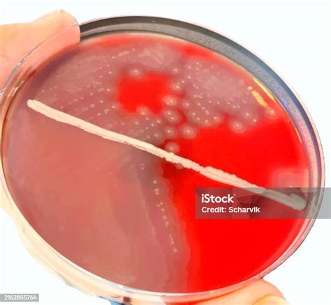 proteus vulgaris grown  blood  plate stock photo  image