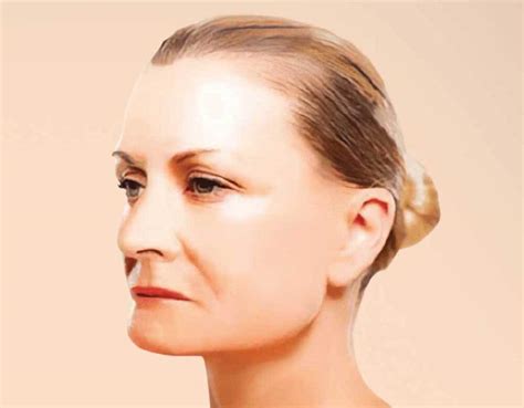 fixed implants  dentures fixed teeth australia