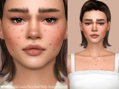 Sims 4 Cc Skin Details Acne