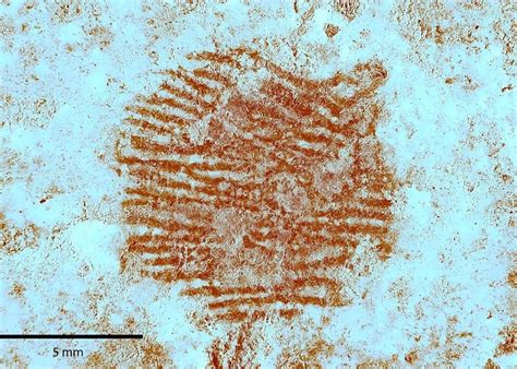 First known tuberculosis cases in Neanderthals revealed in Subalyuk ...