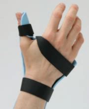 extensor tendon injury splint