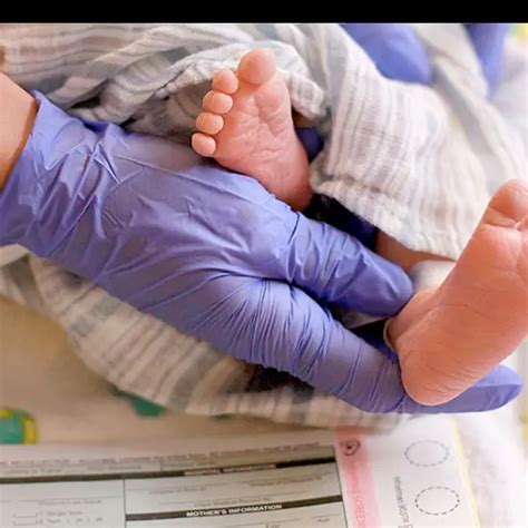 Galactosemia Newborn Screening | Test Price In Delhi | Cost Near Me ...