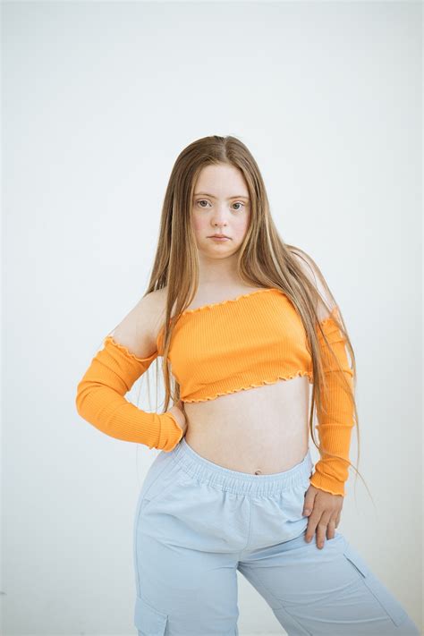 mia  zbd talent models  disabilities visible differences