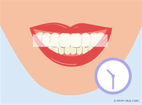 how long to leave whitening strips on