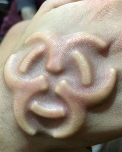 atdatabases  subdermal implant   body modification