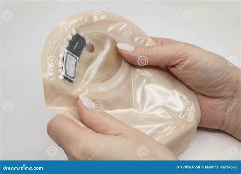 Top View On Colostomy Bag, Supplies Needed After Colostomy Surgery ...