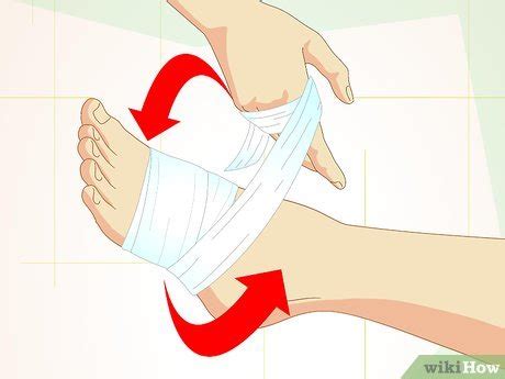 4 Ways to Care for Superficial Wounds - wikiHow