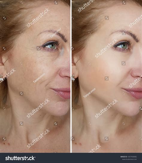 The InfluencerGoneWild Before & After That's Dividing The Internet Image 13