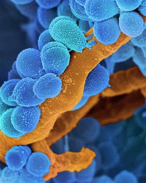 Streptococci Art - Pixels