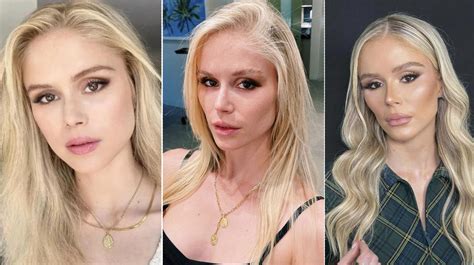 InfluencerGoneWild's Plastic Surgery REVEALED: Before & After. Image 4
