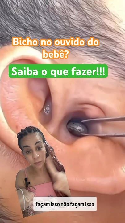 Como Saber Se Tem Um Bicho No Meu Ouvido - Saiba o que deve e o que não deve fazer com um bichinho no ouvido do ...