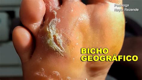 Bicho Geografico Fase Inicial - 8
