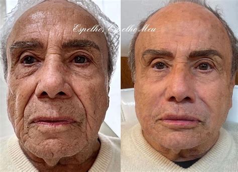 Antes Que O Mundo Acabe Livro - Bella Longuinho mostra antes de depois de transição de gênero; vídeo