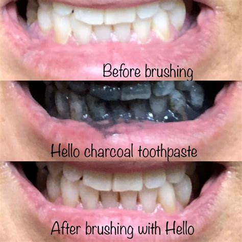 Charcoal Toothpaste Sensitive Teeth at Donna Champion blog
