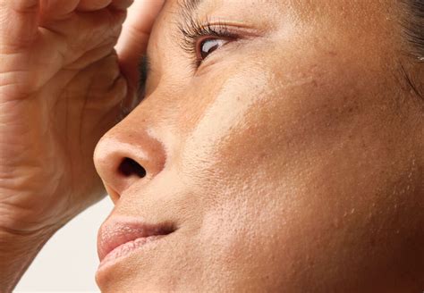 rid  textured skin    prose