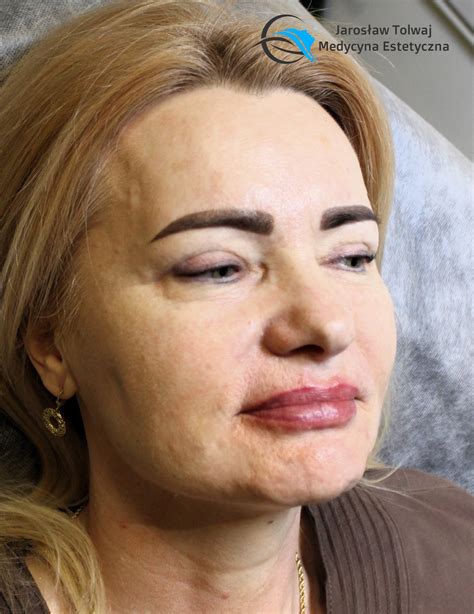 Jarosław Tolwaj... - Jarosław Tolwaj Medycyna Estetyczna