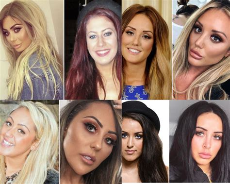 Geordie Shore Cosmetic Surgery Transformations - BuzzPopDaily