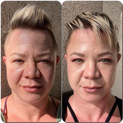 611 best Botox images on Pholder | Plastic Surgery, SC Acirclejerk and