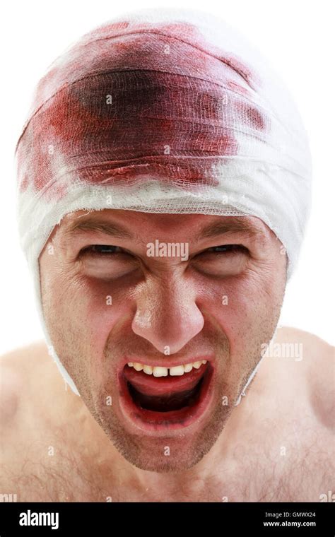 Bandage on blood wound head Stock Photo, Royalty Free Image: 116124572 - Alamy