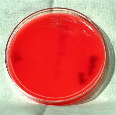 Free picture: brucella abortus, disease, brucellosis