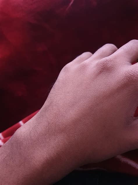 I'm 22 years old boy. my skin is super wrinkly, it's been like this