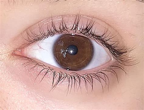 Is my sclera a healthy white or tinted blue? I’m a bit health anxious ...