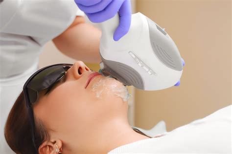 Does IPL Skin Rejuvenation Help Get Rid Of Acne Scars? - Lovoir Beauty