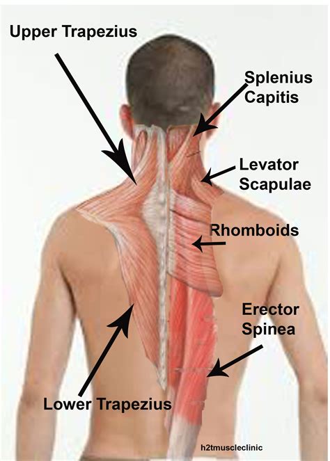 Lower Back Muscles List : 6 Low Back Pain Symptoms Locations Treatments
