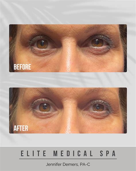 Elite Medical Spa of Sarasota | Sarasota FL