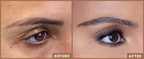 Can Eyebrows Grow Back? 10 Things To Consider