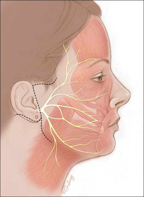 What is the Facial Nerve? | Otolaryngology⁠ — Head & Neck Surgery ...