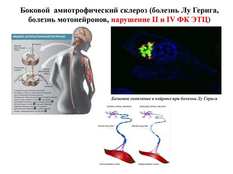 Перекисное окисление липидов. Характеристика, продукты, биологическая и ...