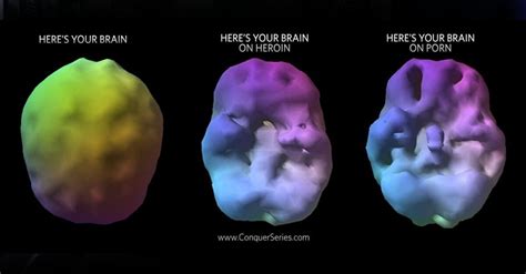 porn    brain    quit  mohammedraza esmail