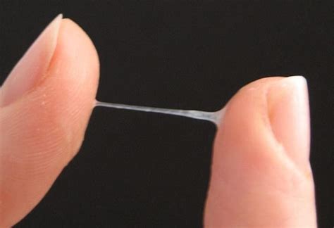 Corrimento Transparente E Elastico - Corrimento vaginal: o que é normal? - Instituto Villamil