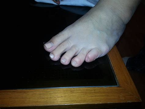 My girlfriend has the ugliest feet : WTF