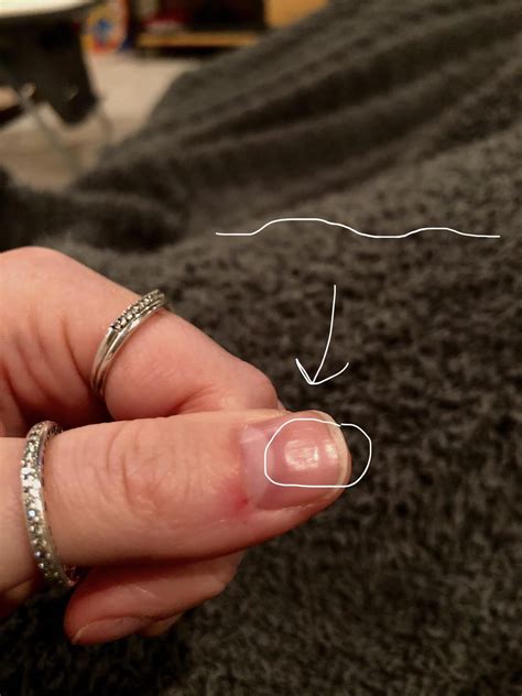 Any thoughts on why my nails look like this? : TheGirlSurvivalGuide