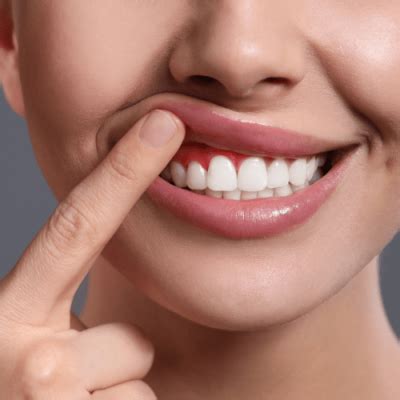 flap surgery skin  smiles